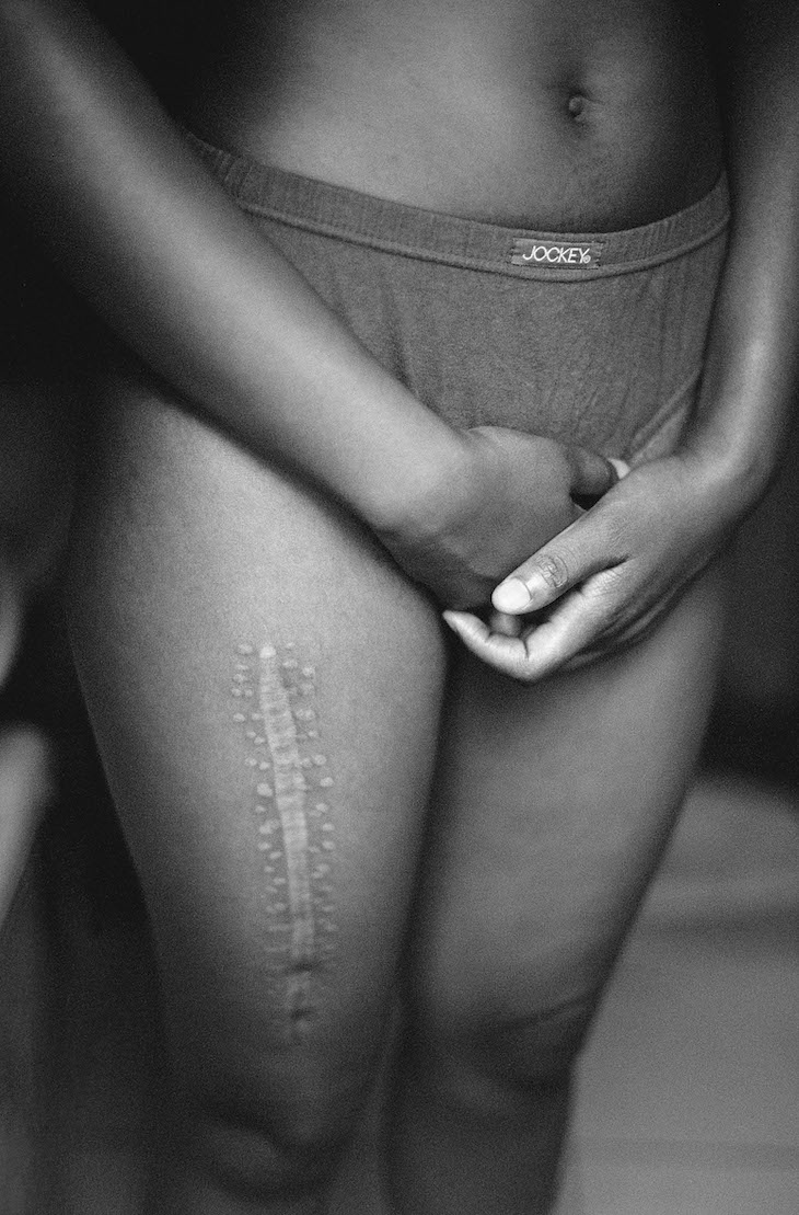 Aftermath (2004), Zanele Muholi.