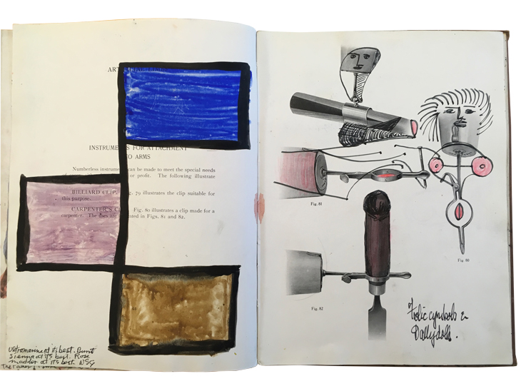 Drawings by W.S. Graham over the pages of 'Artificial Limbs: For Use After Amputation and Congenital Deficiencies' by F.G. Ernst (1923).