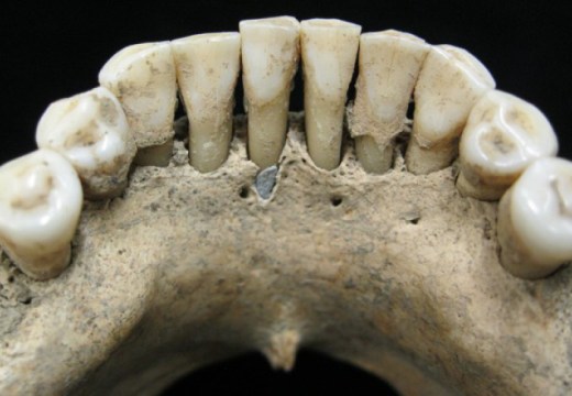 A fleck of lapis lazuli found in the lower jaw of a female skeleton from the 11th or 12th century, Photo: Christina Warinner