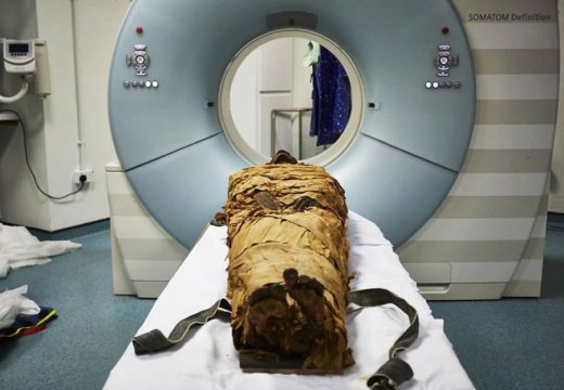 An ancient Egyptian mummy, Nesyamun, laid on the couch to be CT scanned at Leeds General Infirmary.