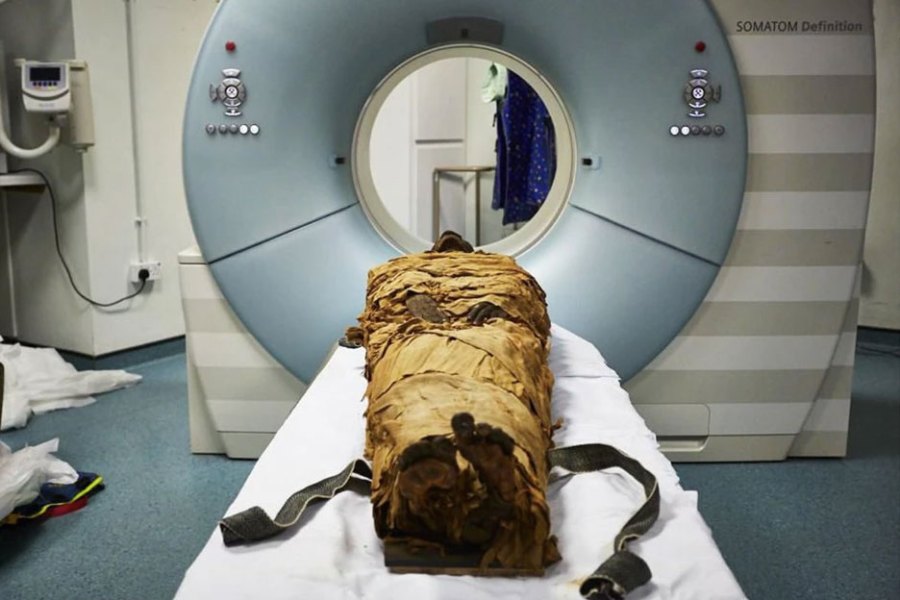 An ancient Egyptian mummy, Nesyamun, laid on the couch to be CT scanned at Leeds General Infirmary.