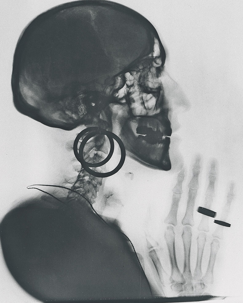Meret Oppenheim X-Ray